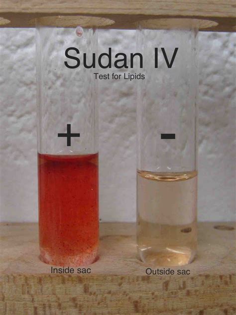 [Solved] Sudan IV lipid test lab report and background information | Course Hero