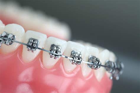 ORTHODONTIC ASSISTANT COURSE | KAIROSCC