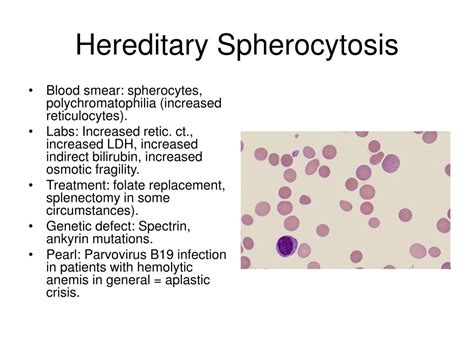 PPT - Hematology-Oncology Review Session PowerPoint Presentation, free download - ID:890258