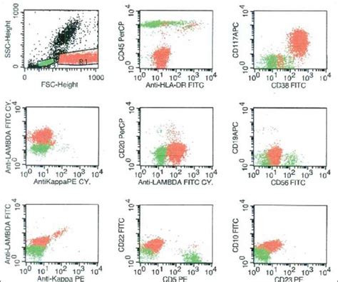 Flow cytometry on the peripheral blood showed the plasma cells (painted ...