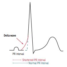 Pin on Cardio Review