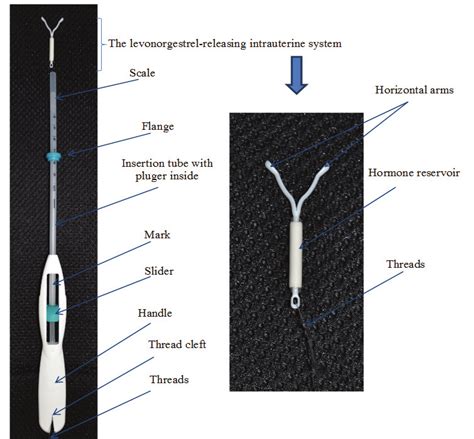 The levonorgestrel-releasing intrauterine system and inserter | Download Scientific Diagram