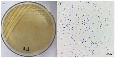 Pseudomonas Aeruginosa Gram Stain 1000x