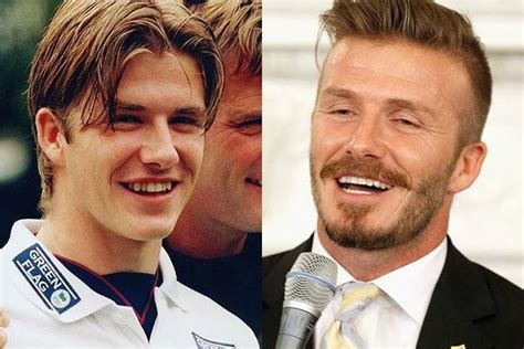 David Beckham before and after-thanks to the dentists series 2 #dentalscanner #dentists # ...