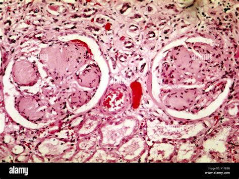 Kidney histology hi-res stock photography and images - Alamy