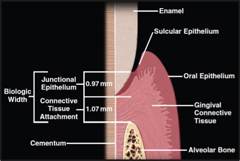 Image result for biological width Dental Hygiene School, Stoma, Mnemonics, Dentistry, Bridges ...