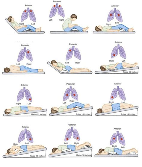 Postural Drainage Positions - Best Drain Photos Primagem.Org