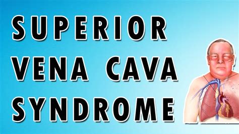 Inferior Vena Cava Syndrome