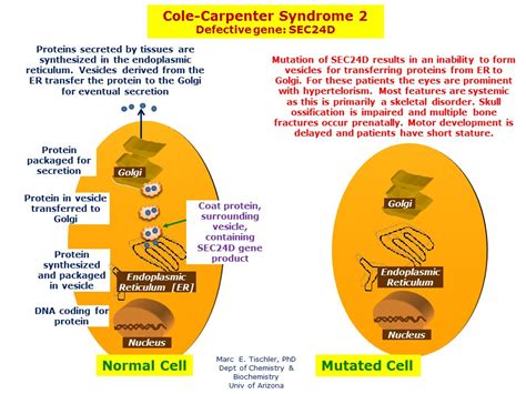 Cole-Carpenter Syndrome 2 | Hereditary Ocular Diseases