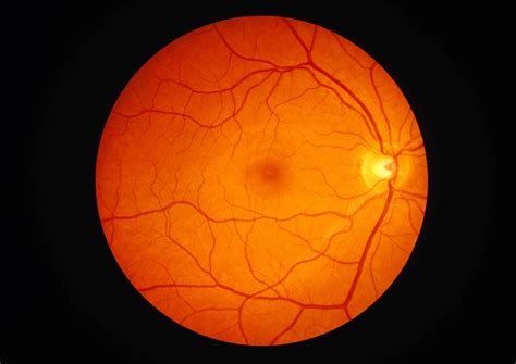 The Anatomy of the Retina