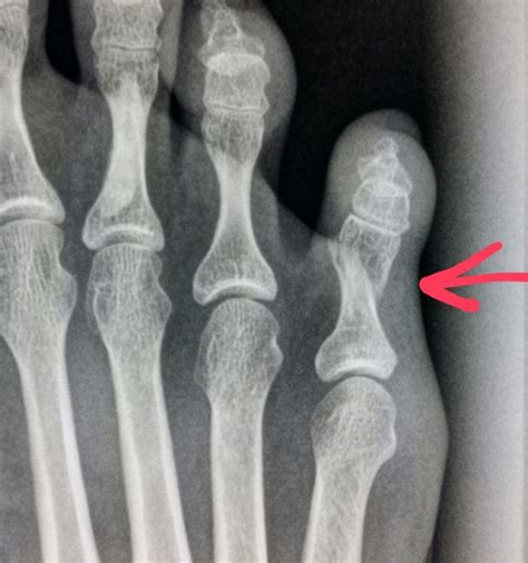 Pin en Unusual X-rays