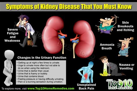 Top 10 Symptoms of Kidney Disease that You Need to Know | Top 10 Home Remedies