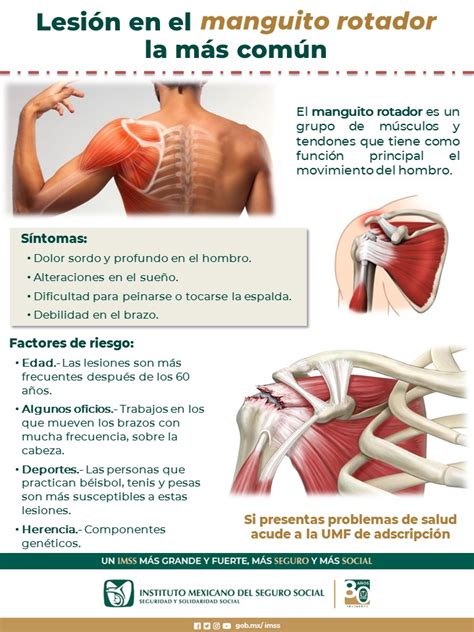 Lesión en el “Manguito Rotador”, viene de la sobreutilización del hombro: IMSS Chihuahua 👉 Local ...