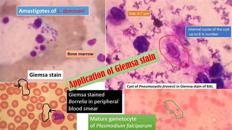 Giemsa stain: Introduction, preparation, principle, procedure and result