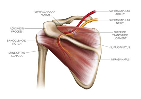 Sports Injury Bulletin - Diagnose & Treat - Suprascapular nerve injury: a common entrapment for ...