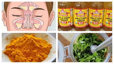 Best Natural Home Remedies for Blocked Sinuses