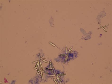 Microscopic Analysis of Urine | Faculty of Medicine, Masaryk University