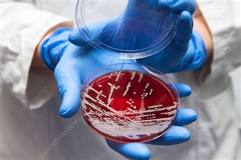 Staphylococcus aureus culture - Stock Image - C035/7525 - Science Photo Library