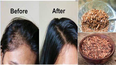 Your Hair Will Grow Like Crazy! Just Eat 1 TableSpoon Daily for Hair Growth, FLAXSEEDS for Long ...