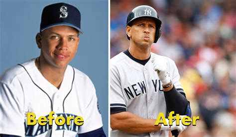 Alex Rodriguez Before After Steroids