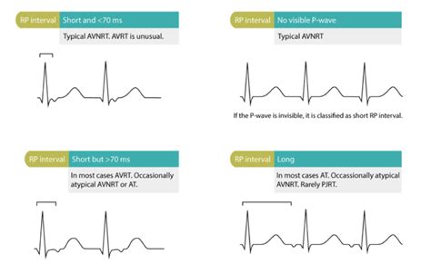 Adenosine - Therapeutic and Diagnostic? - JournalFeed