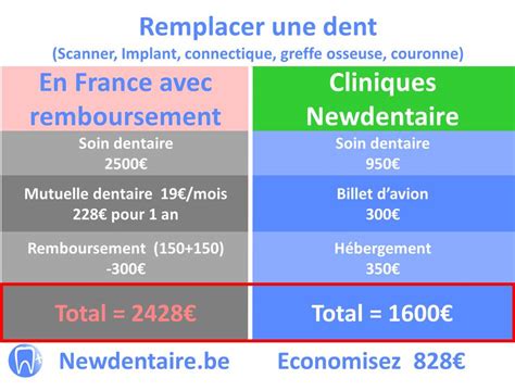 Remboursement implant dentaire France | Newdentaire