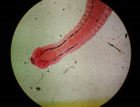 Tapeworm Under A Microscope