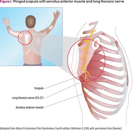 Anatomy Of Scapular Winging