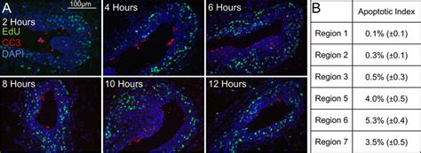 Analysis of apoptosis by Cleaved Caspase III (CC3) staining. Apoptotic ...