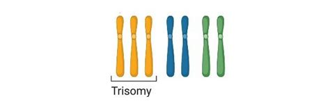 Aneuploidy: Definition, Types, Causes, and Examples