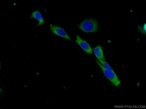 Beta-2-microglobulin Antibody (13511-1-AP)