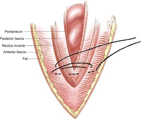 Surgical Techniques | Oncohema Key