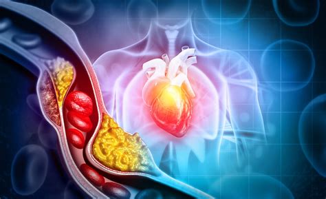 What seniors should know about cholesterol and heart disease - Boom ...