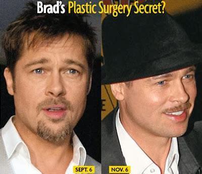 Brad Pitt Botox and Facial Fillers Plastic Surgery Before and After