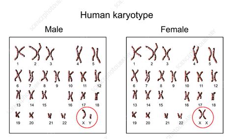 Y Chromosome Karyotype