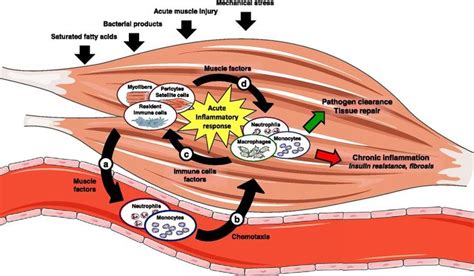 Idiopathic Inflammatory Myositis - Arthritis Rheumatism