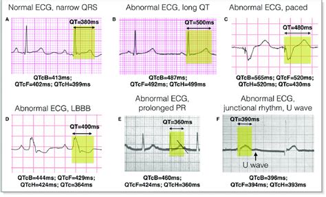 qt interval chart - Keski