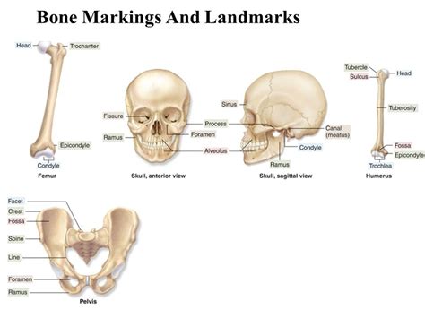 Tubercle Bone Marking