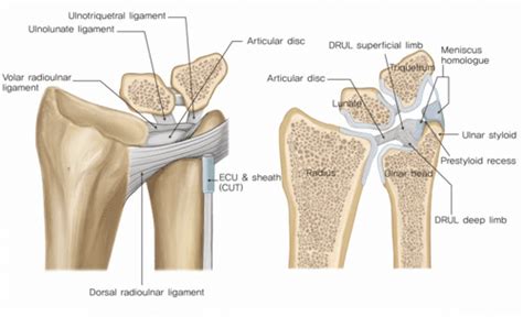 Figure 1 from IFSSH Scientific Committee on Bone and Joint Injuries: Distal Radioulnar Joint ...