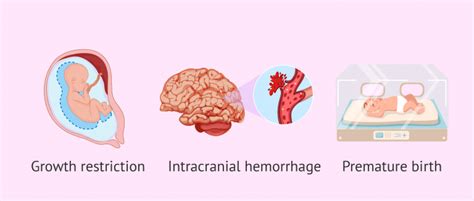 Complications of pregnancy from heart disease