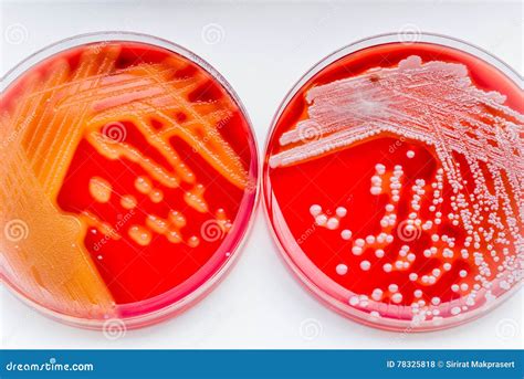 Staphylococcus Aureus and Streptococcus Pyogenes Stock Photo - Image of pyogenes, agar: 78325818