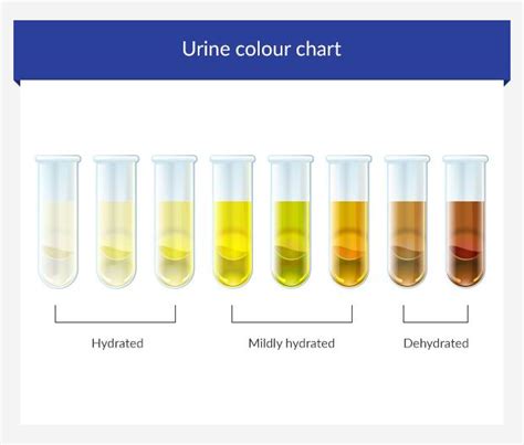 Changes in your urine and what it means • euroClinix®