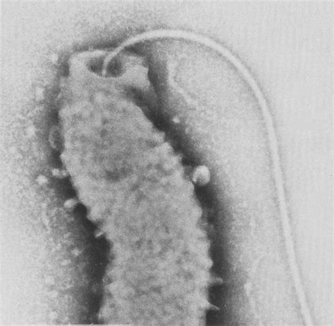 Figure 1 from Electron microscopy of Campylobacter jejuni. | Semantic ...