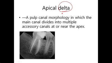 신경치료6(해부학: apical delta 등) - YouTube