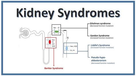 Gitelman Syndrome - overview - Chronic Kidney Disease Explained