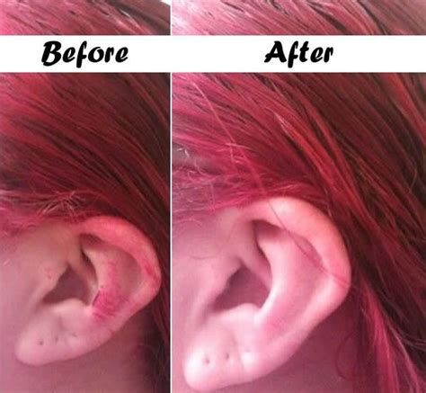 Useful Ideas On How To Remove Hair Dye From Skin - AllDayChic