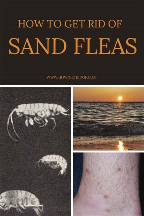 How To Get Rid Of Sand Fleas - How I Get Rid Of