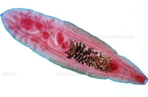 Class Trematoda - Chinese Liver Fluke Diagram | Quizlet