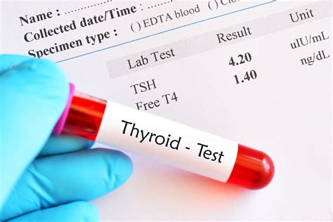 Low Thyroid: Taking Levothyroxine, But Still Don’t Feel Right? - Desert Health®