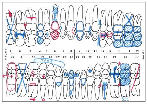 Dental Charting Practice Sheets